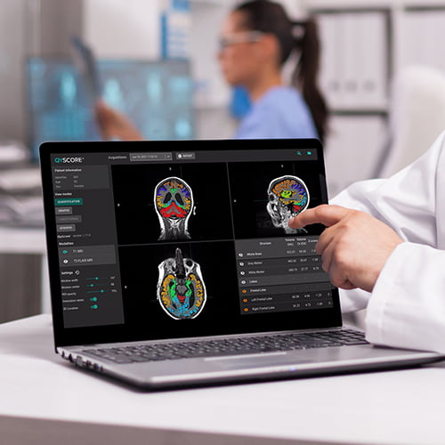 QYNAPSE (France) and TRUE POSITIVE MEDICAL DEVICES (Canada) are partnering to provide the most advanced AI platform for brain diseases